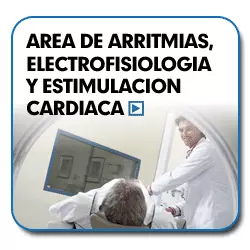 Área de arritmias electrofisiología y estimulacion cardíaca