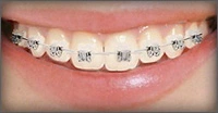 Endodoncia clinica Salvador