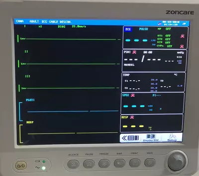 Hospital MB: Hospitalización